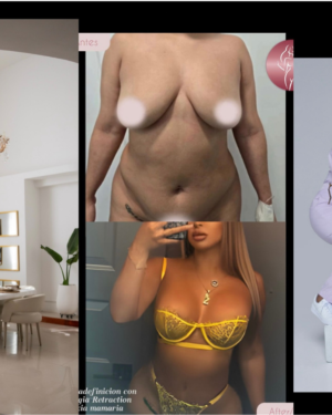ARTE DIGITAL | Cirugía Plástica en Colombia